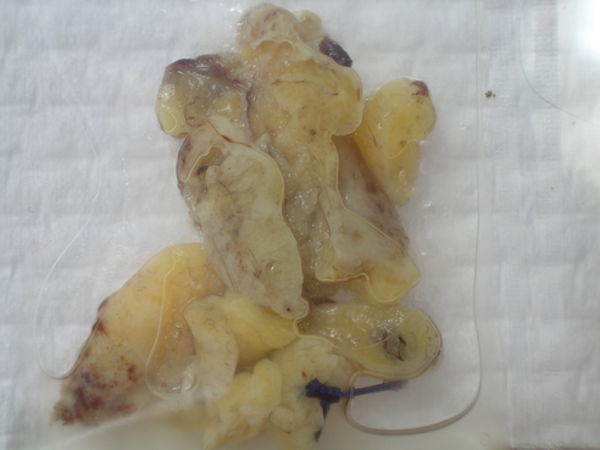 The Appendix -- a closer look